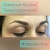 Зажившие брови. Перед коррекцией