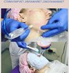 Микрофракционная мезотерапия