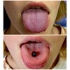 Пирсинг языка